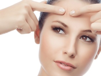 How To Get Rid of Acne Naturally, Indian Skincare Blog, Home Remedies, DIY, Acne