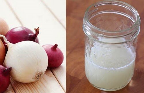 Onion Juice For Hair - 5 Benefits & Ways to Use
