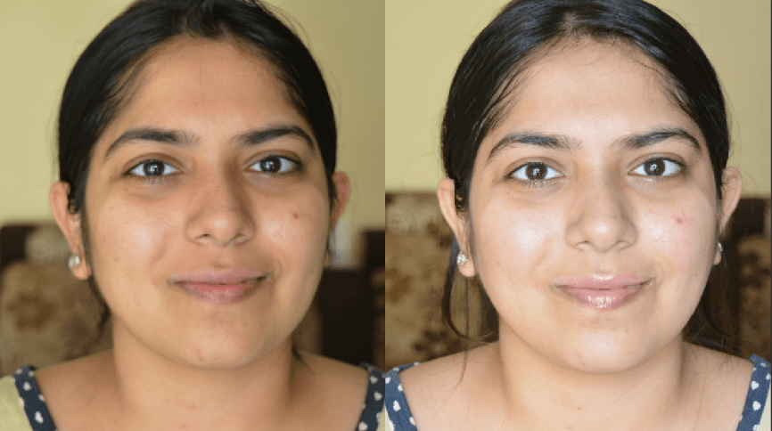 Clear, Glowing Skin for Diwali | Remove Tan & Dead Skin Cells | DIY Natural Skincare